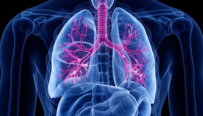 什么是慢性阻塞性肺病 (Chronic Obstructive Pulmonary Disease)，為何與新冠疫情有關(guān)？